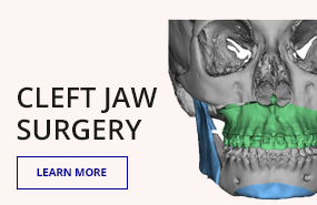 Cleft Jaw Surgery