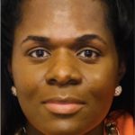 Facial Feminization Before & After Patient #2199