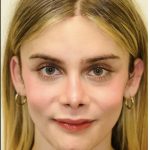 Facial Feminization Before & After Patient #2192