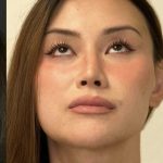 Facial Feminization Before & After Patient #2204