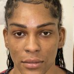 Facial Feminization Before & After Patient #2210