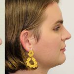 Facial Feminization Before & After Patient #2219