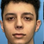 Rhinoplasty Before & After Patient #2189