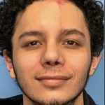 Rhinoplasty Before & After Patient #2189