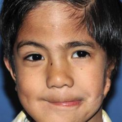 Craniofacial Before & After Patient #1194