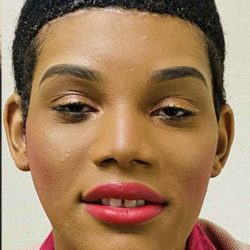 Facial Feminization Before & After Patient #906