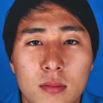Rhinoplasty Before & After Patient #1023