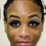Facial Feminization Before & After Patient #894