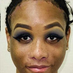 Facial Feminization Before & After Patient #894