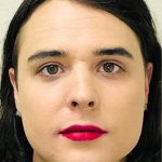 Facial Feminization Before & After Patient #876