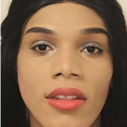 Facial Feminization Before & After Patient #906