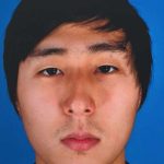 Rhinoplasty Before & After Patient #1023