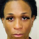 Facial Feminization Before & After Patient #894