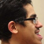 Jaw Surgery Before & After Patient #1137