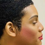 Facial Feminization Before & After Patient #906